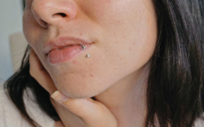 Tips For Clear Skin